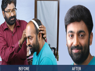 PRAKASH - WIGS.HAIR FIXING