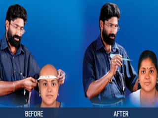 PRAKASH - WIGS.HAIR FIXING